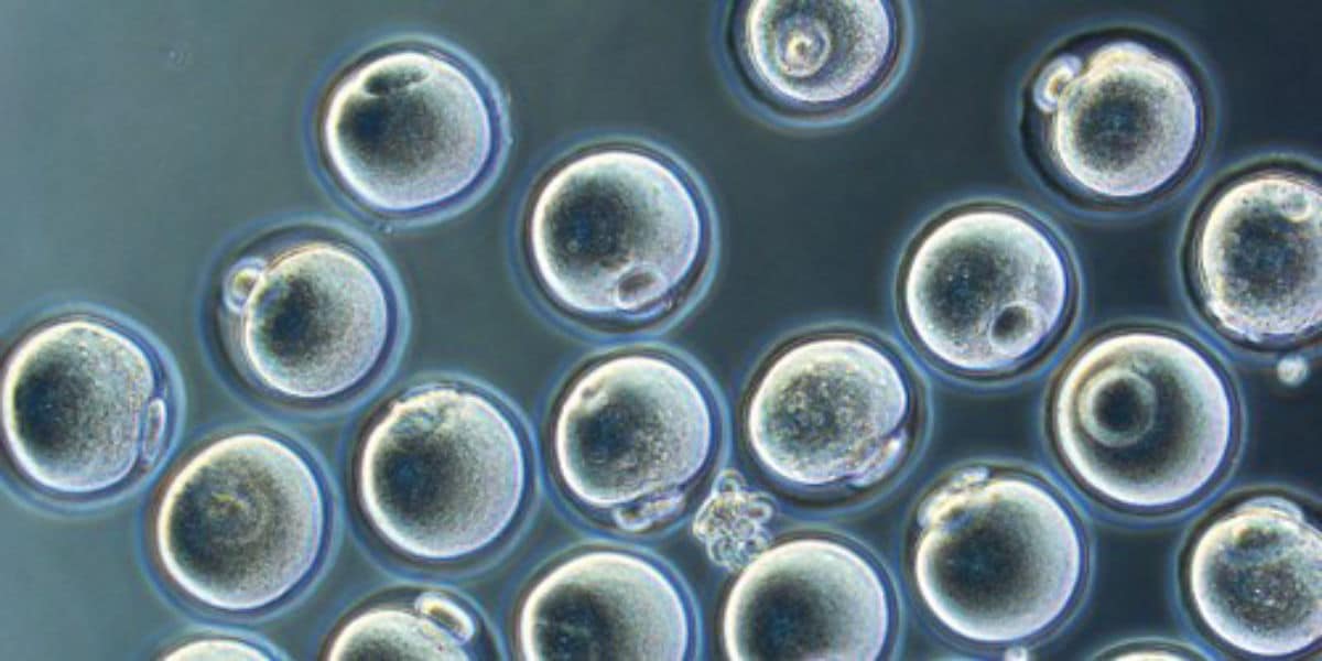 Mature oocyte ready for cryopreservation
